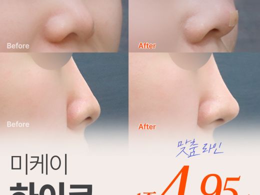 미케이 자신감있는 콧대 민트실_하이코