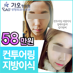 프리미엄 컨투어링 지방이식