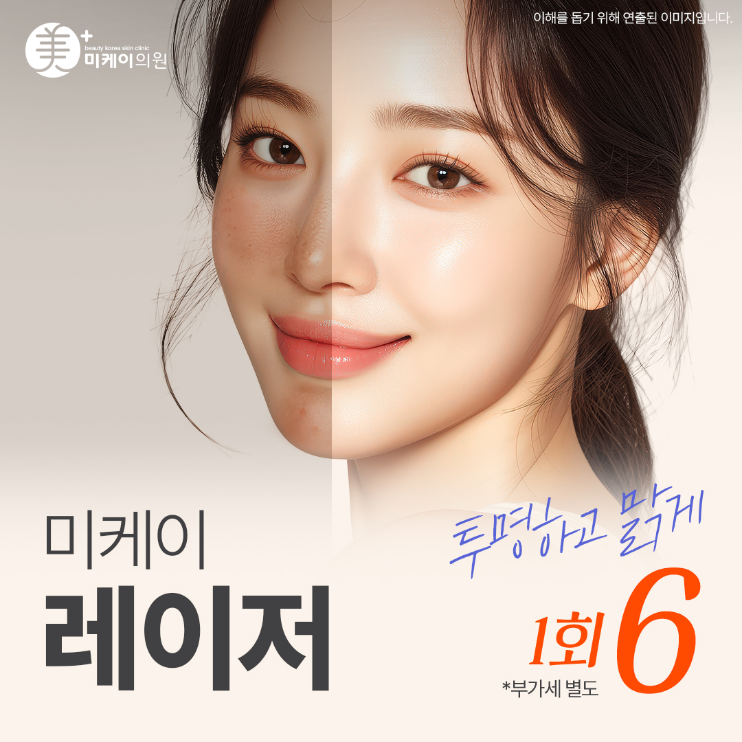 미케이 기미 잡티 색소침착 여드름 자국 지우개_레이저토닝