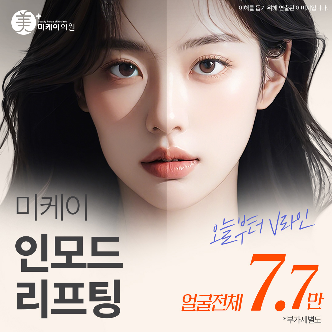 미케이 인모드 포마_얼굴탄력, 브이라인, 이중턱 박살