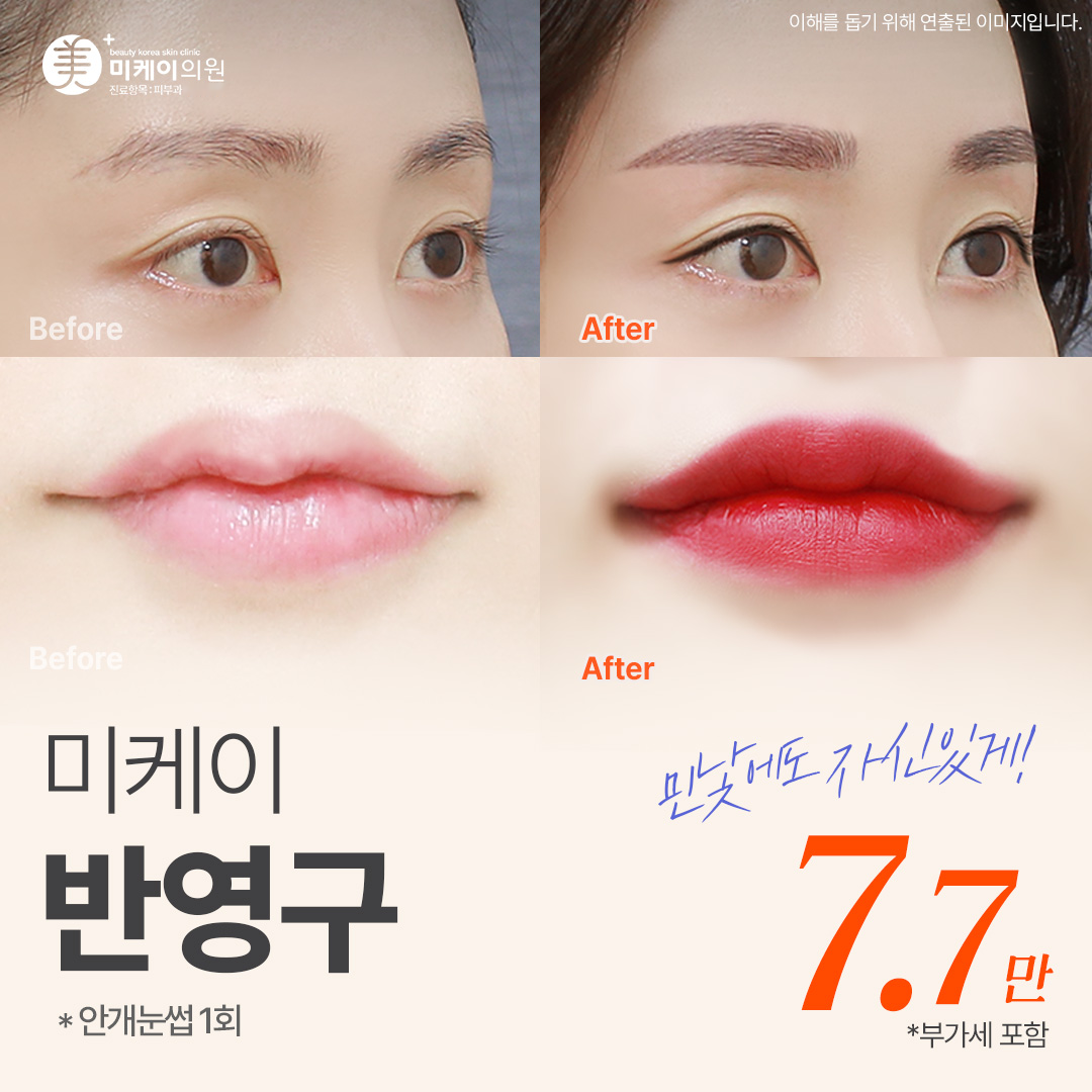미케이 민낯에도 자신있는 반영구_눈썹, 아이라인, 애교, 입술, 두피, 헤어라인