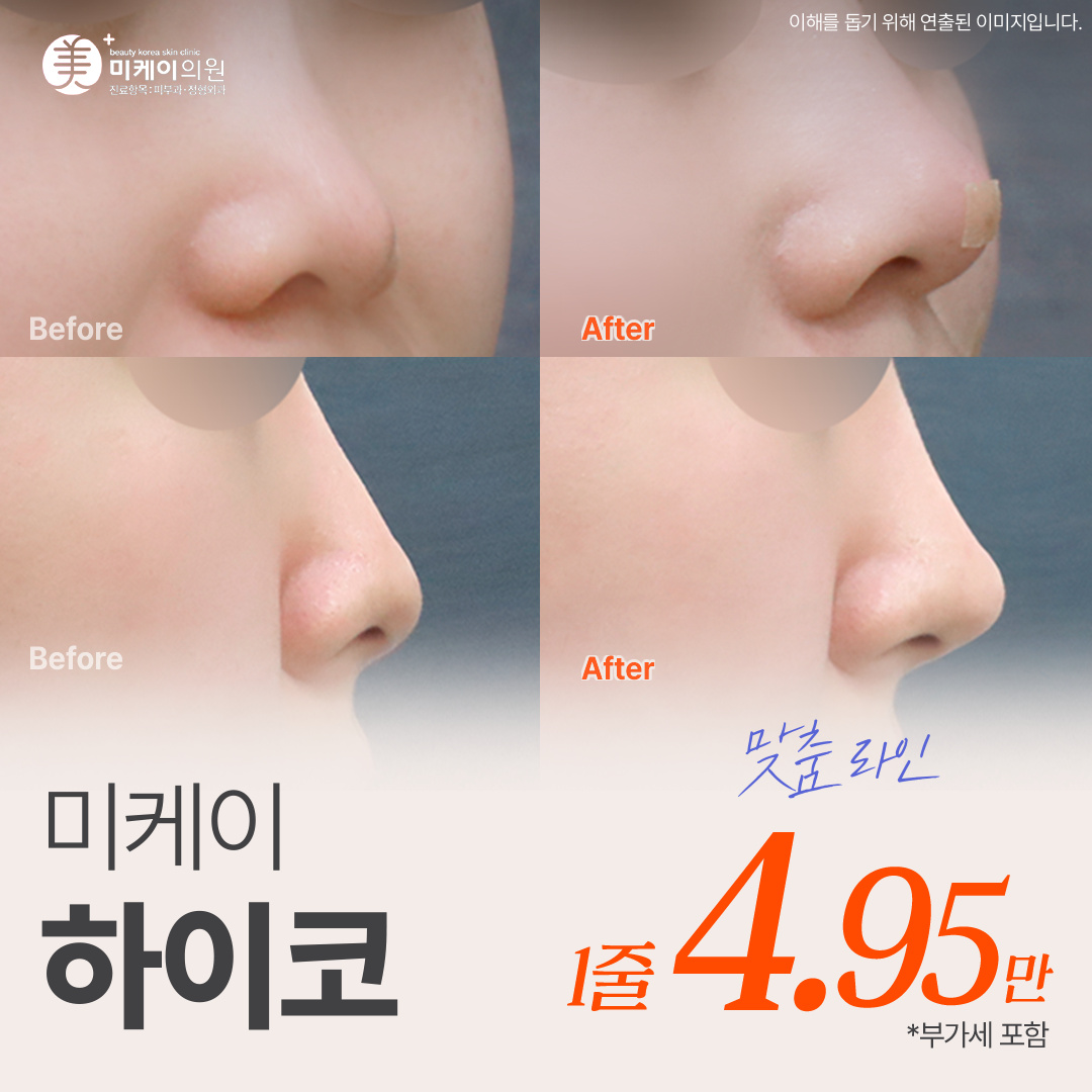 미케이 자신감있는 콧대 민트실_하이코