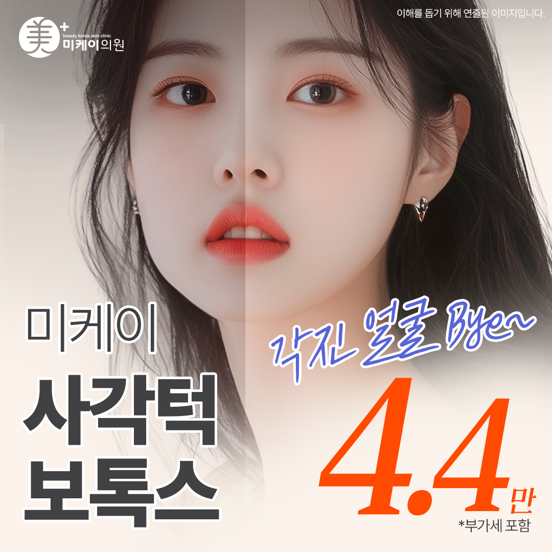 미케이 사각턱 보톡스 50유닛