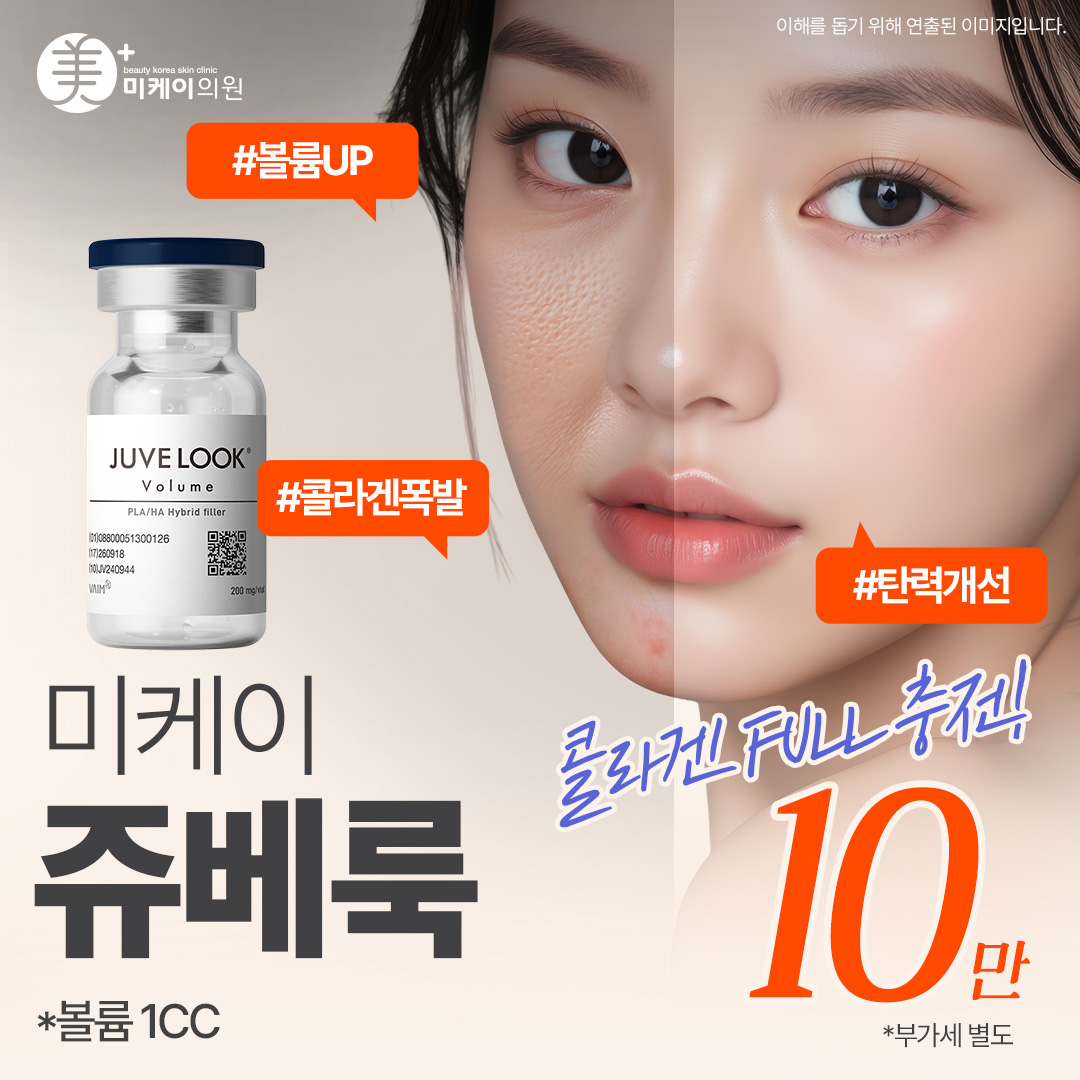 미케이 콜라겐 충전 스킨부스터 쥬베룩 볼륨&스킨