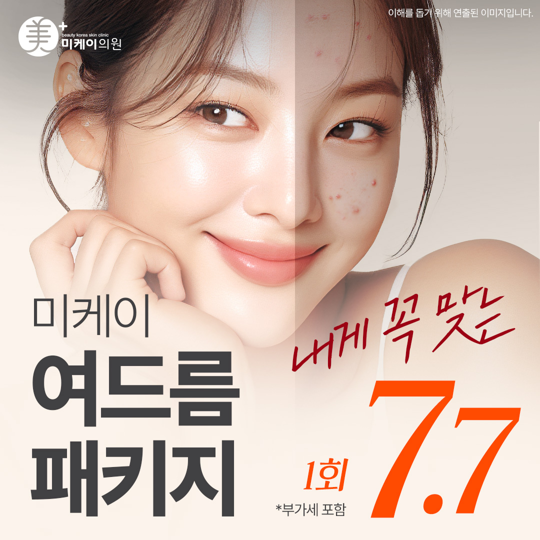  미케이 내게 꼭 맞는 여드름 패키지 이벤트_피부관리, 압출, 염증주사