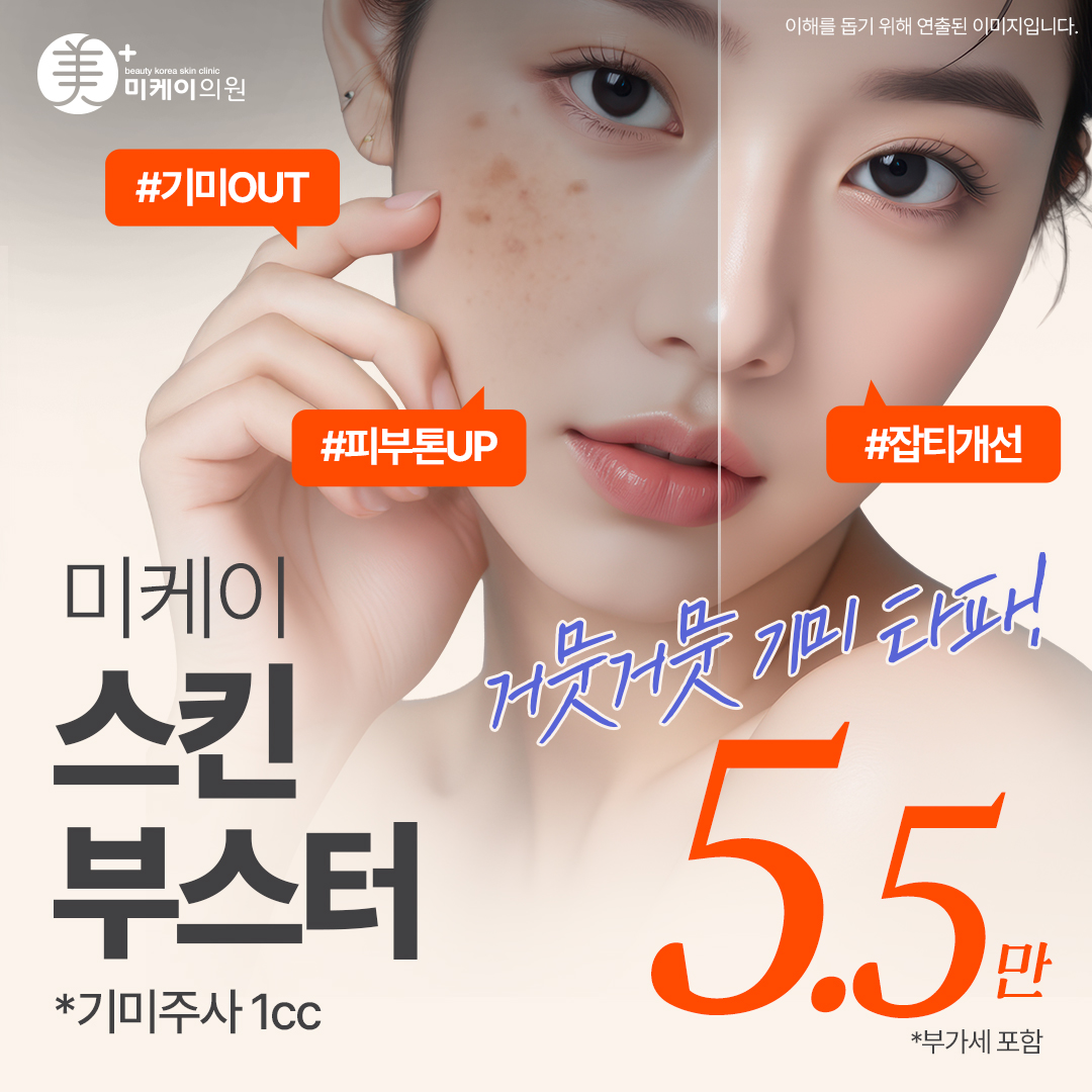 미케이 기미&잡티 개선 스킨부스터_기미주사 1cc, 물광주사, 리쥬란힐러, 쥬베룩스킨, 바이리즌