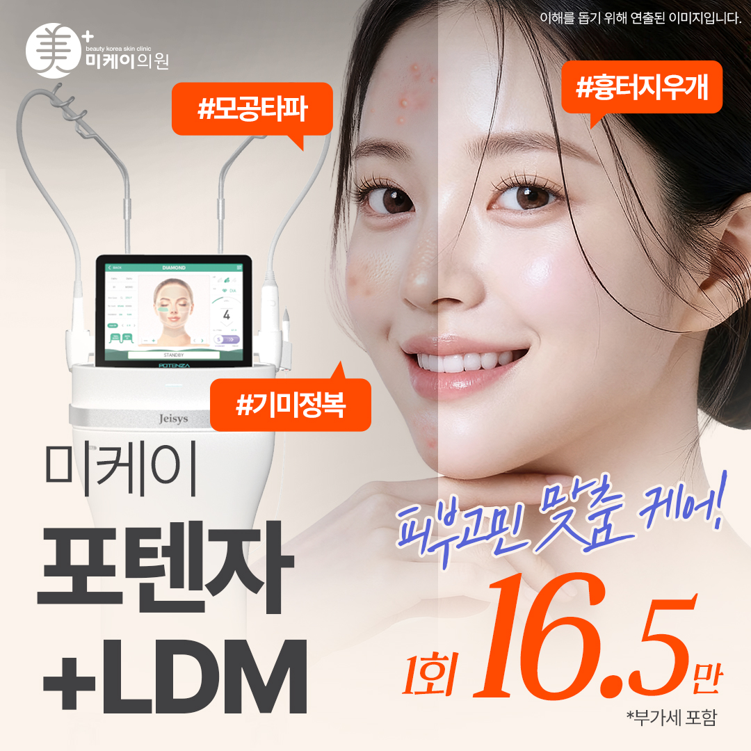미케이 넓은 모공, 여드름 흉터, 피부결 개선엔_포텐자&LDM