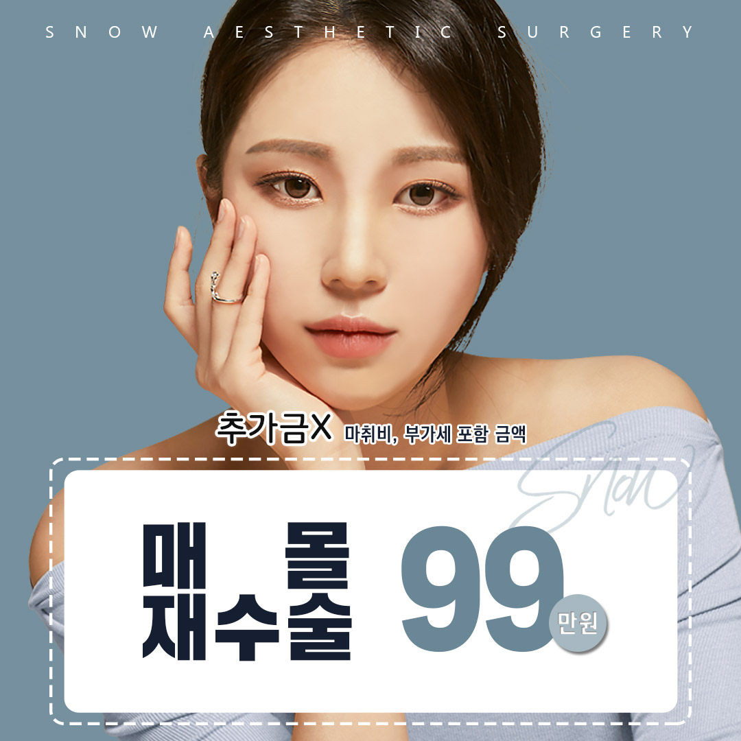 비밀눈성형 매몰재수술