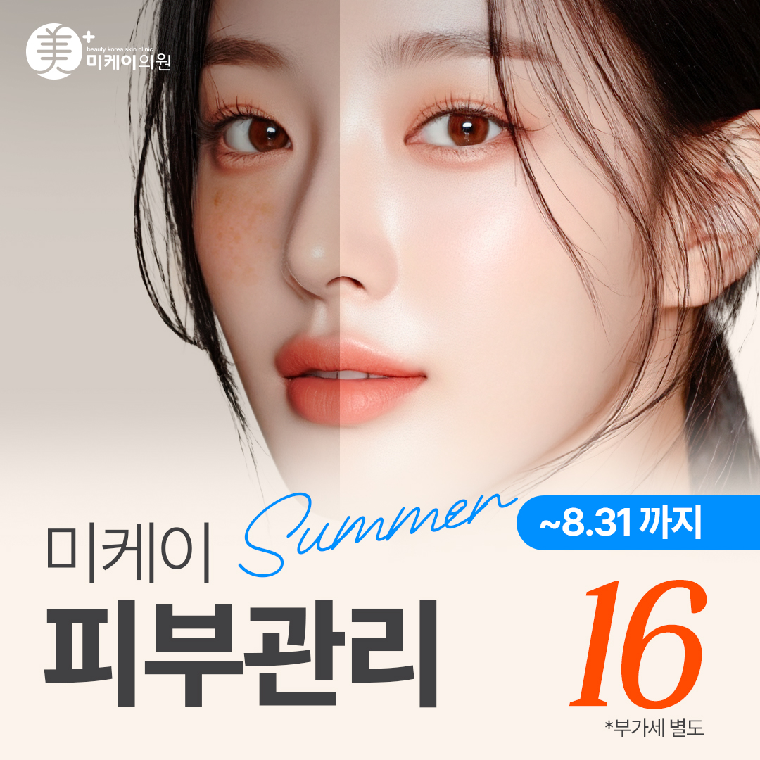 미케이 여름철 피부관리 패키지 이벤트_레이저토닝, 백옥주사, LDM