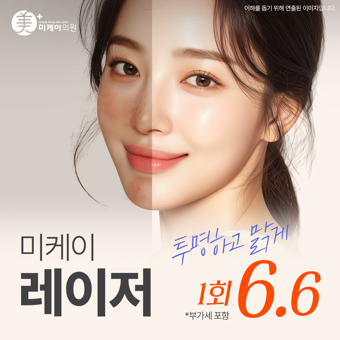 미케이 피부톤 개선, 기미&색소&홍조 개선, 문신제거_레이저토닝