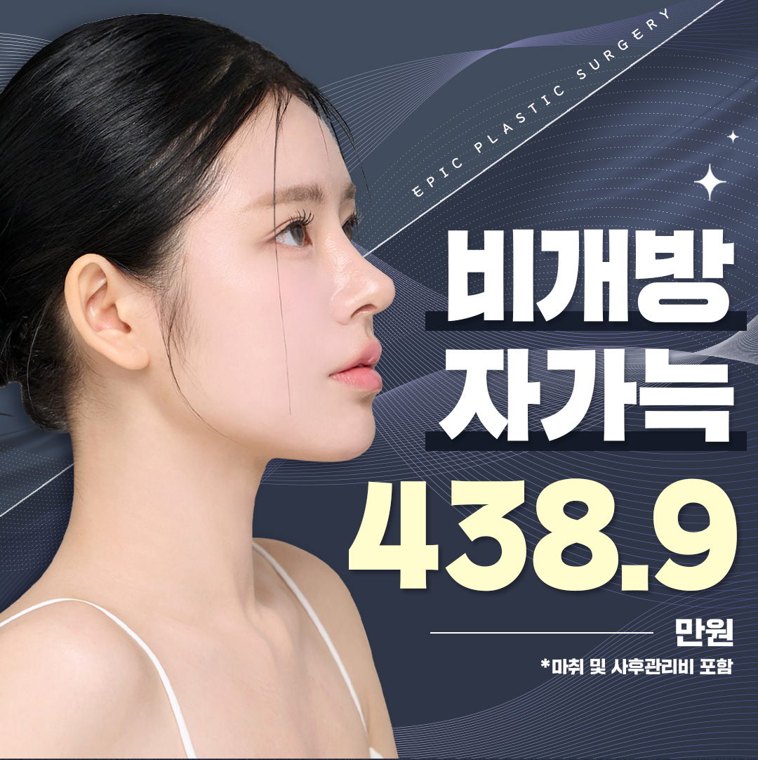 에픽비개방자가늑