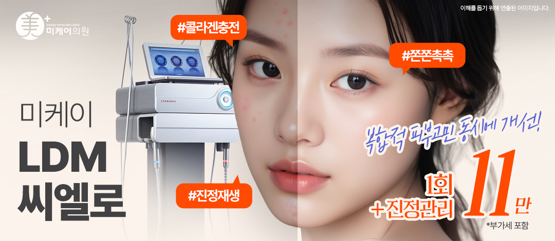미케이 촉촉하고 탄력있는 피부재생_LDM - 미케이의원