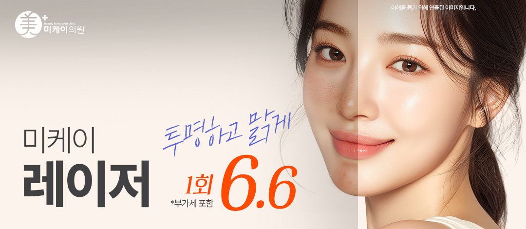 미케이 피부톤 개선, 기미&색소&홍조 개선, 문신제거_레이저토닝 - 미케이의원