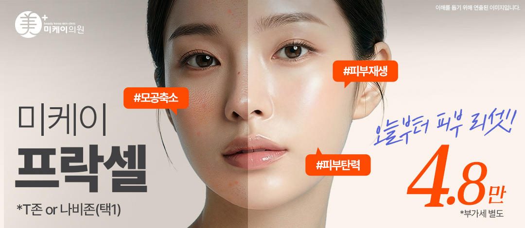 미케이 모공&여드름 흉터 깐달걀 피부_프락셀 - 미케이의원