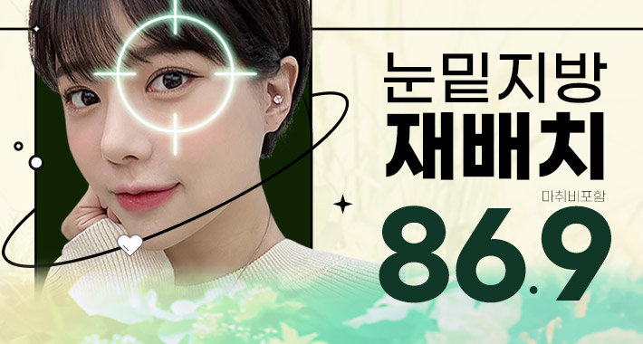 쥬얼리 눈밑지방재배치 - 쥬얼리성형외과