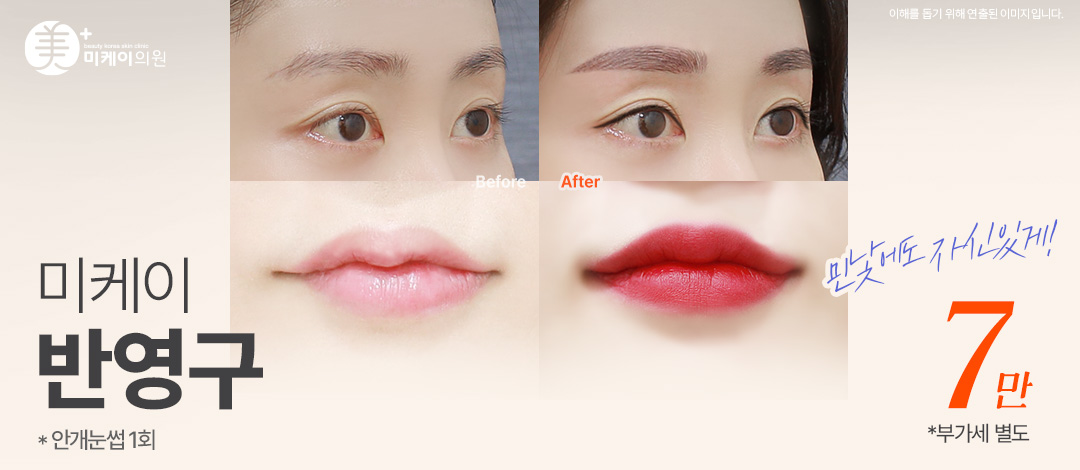 미케이 민낯에도 자신있는 반영구_눈썹, 아이라인, 입술, 두피, 헤어라인 - 미케이의원