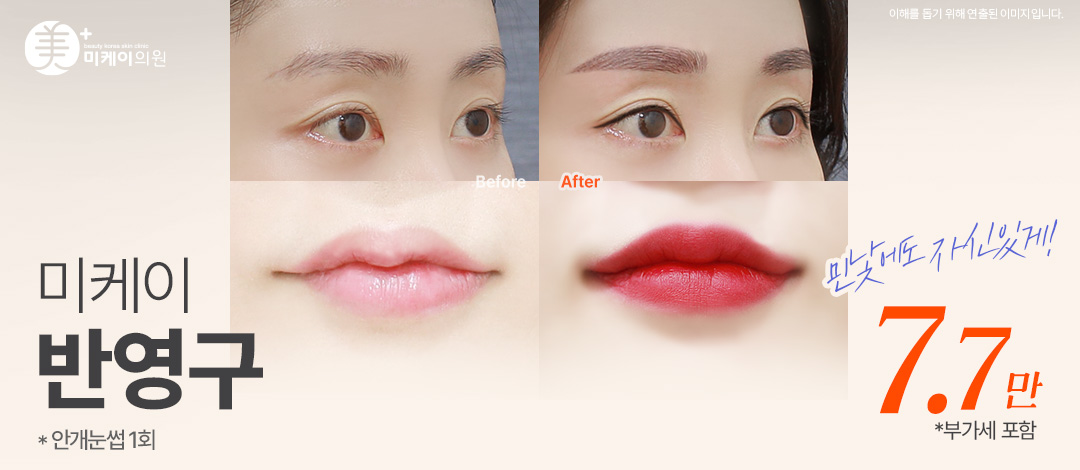 미케이 민낯에도 자신있는 반영구_눈썹, 아이라인, 애교, 입술, 두피, 헤어라인 - 미케이의원