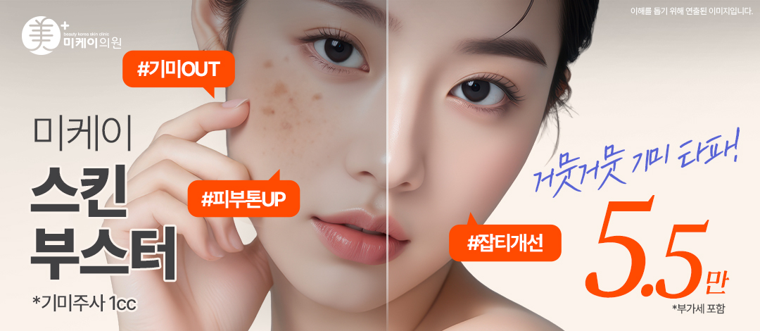 미케이 기미&잡티 개선 스킨부스터_기미주사 1cc, 물광주사, 리쥬란힐러, 쥬베룩스킨, 바이리즌 - 미케이의원